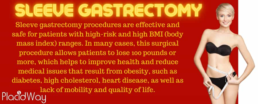 Sleeve gastrectomy weight loss surgery