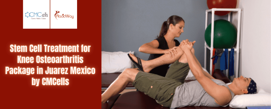 Stem Cell Treatment for Knee Osteoarthritis Package in Juarez Mexico by CMCells
