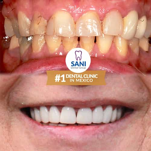 Sani Dental Group Before After