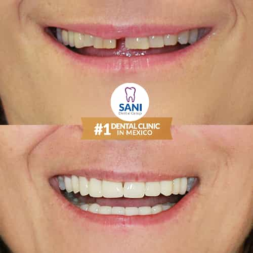 Sani Dental Group Before After