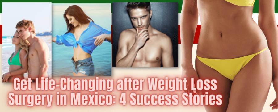 4 Success Story of Patients Get Amazing Life-Changing after Having Weight Loss Surgery in Mexico