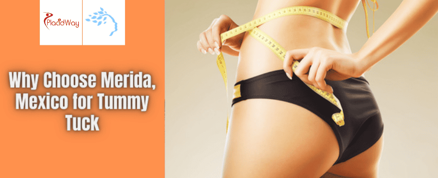 Affordable Tummy Tuck in Merida, Mexico