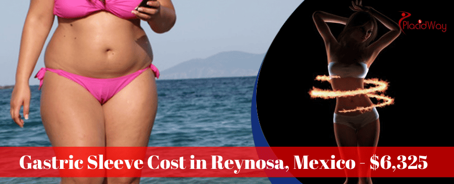 Cost of Gastric Sleeve Surgery in Reynosa