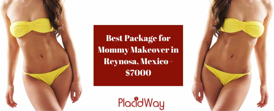 Mommy Makeover in Reynosa, Mexico