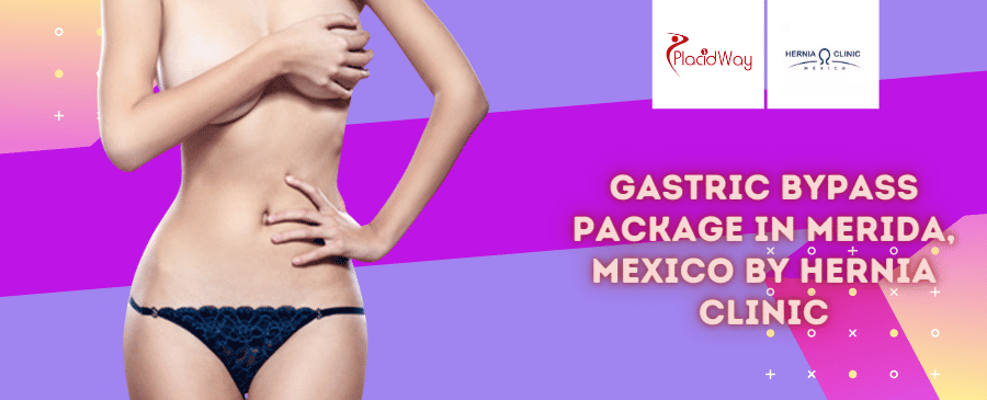 Gastric Bypass Package in Merida, Mexico by Hernia Clinic