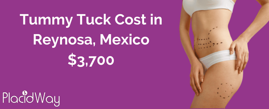 Tummy Tuck Cost in Reynosa, Mexico