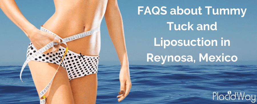 Tummy Tuck in Mexico with Lipo