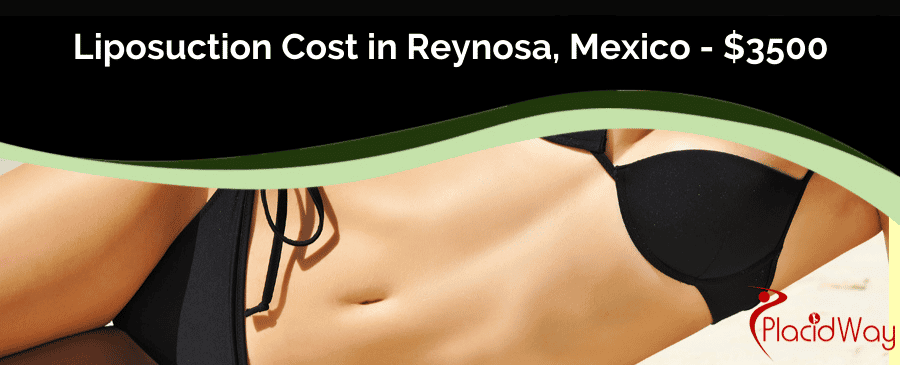  Liposuction Cost in Reynosa, Mexico