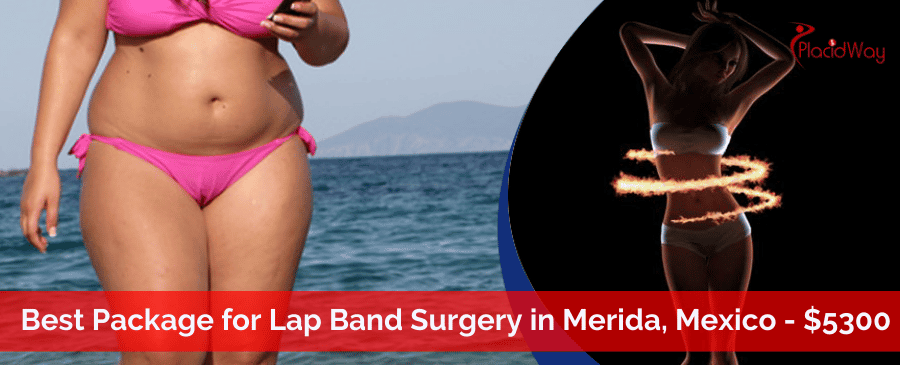Lap Band Surgery in Merida, Mexico