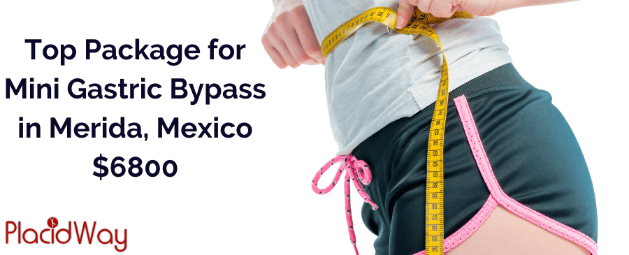 Mini Gastric Bypass in Merida, Mexico