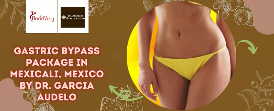 Gastric Bypass in Mexicali