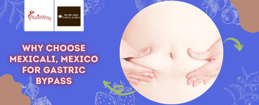Why Choose Gastric Bypass in Mexicali