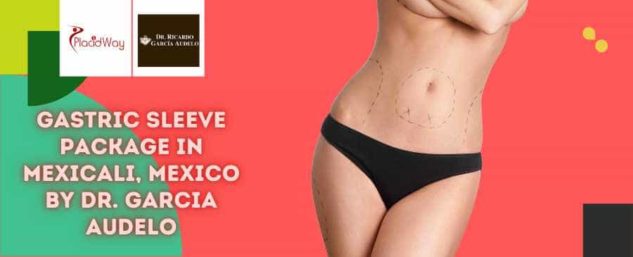 Gastric Sleeve Package in Mexico by Dr. Garcia Audelo