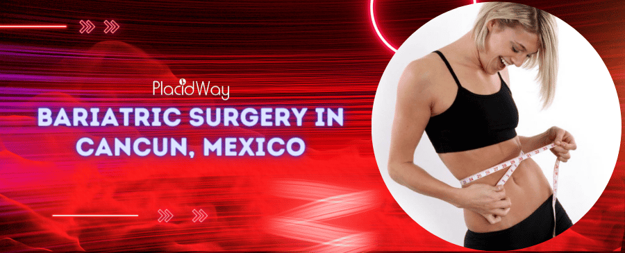 Bariatric Surgery in Cancun, Mexico