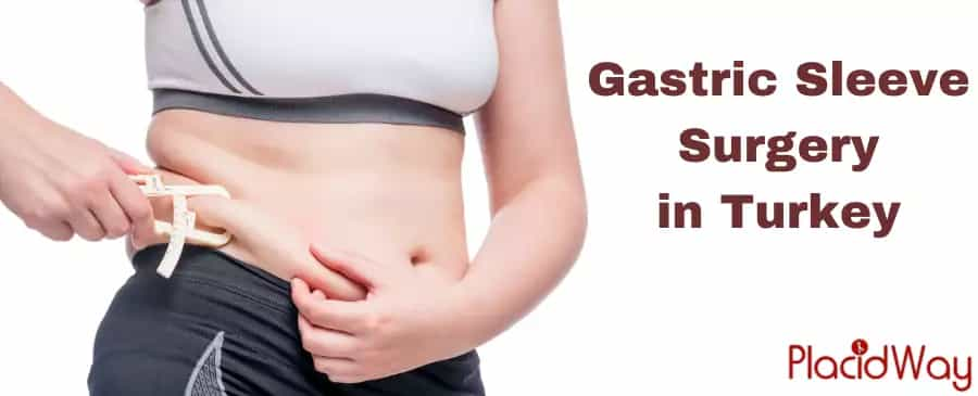 Gastric Sleeve Surgery in Turkey