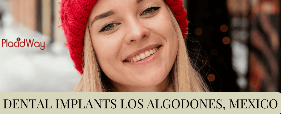 Dental Implants Los Algodones, Mexico