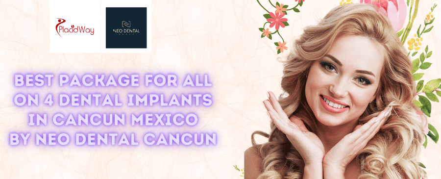 Best Package for All on 4 Dental Implants in Cancun Mexico