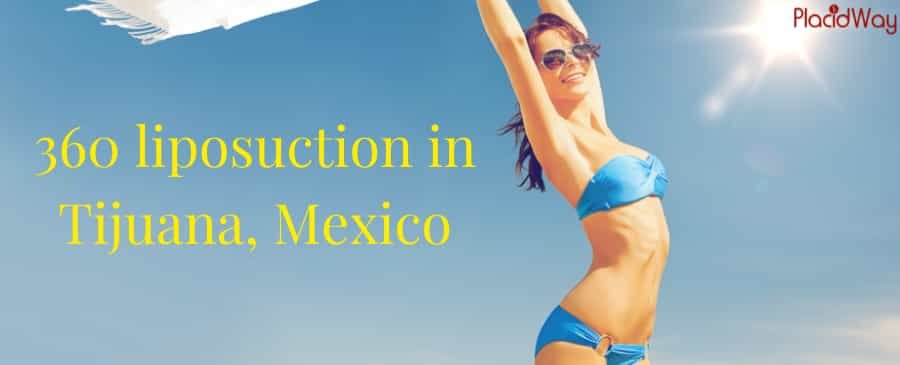 360 Liposuction in Tijuana Mexico