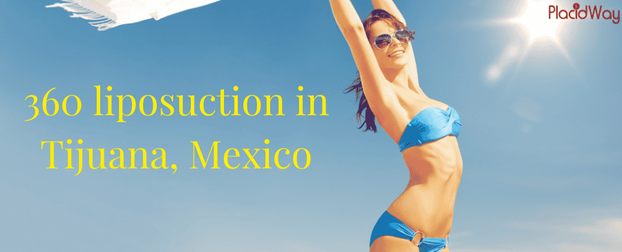 360 Liposuction in Tijuana Mexico Cost