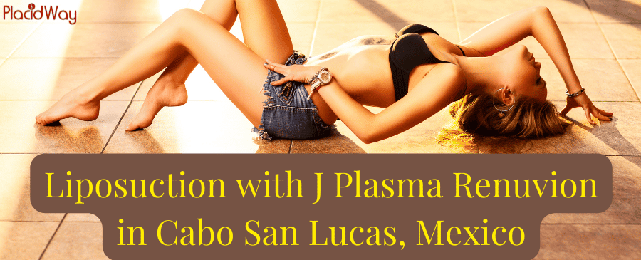 Liposuction with J Plasma Renuvion in Cabo San Lucas, Mexico