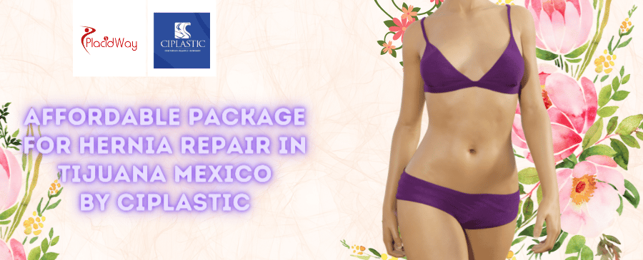 Hernia Repair in Tijuana Mexico by Ciplastic