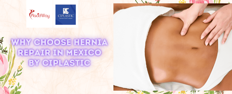 Hernia Repair in Tijuana Mexico by Ciplastic