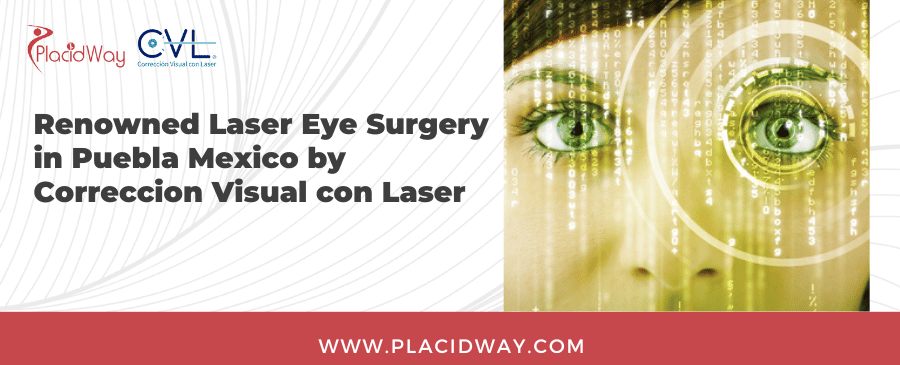 Laser Eye Surgery in Puebla Mexico