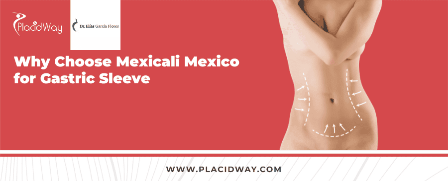 Gastric Sleeve Package in Mexicali Mexico by Dr. Elias Garcia