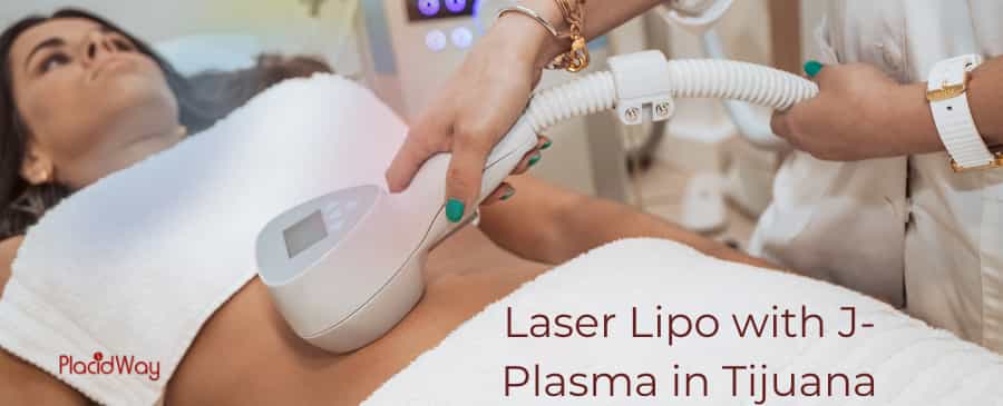 Laser Lipo with J-Plasma in Tijuana