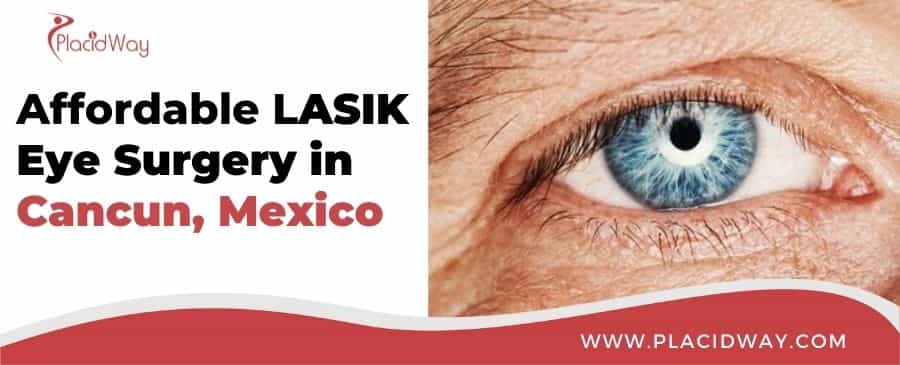 Lasik Eye Surgery in Cancun Mexico