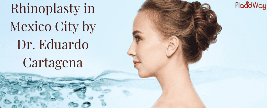 Rhinoplasty In Mexico City