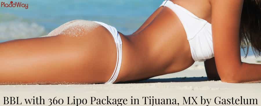 BBL with 360 Lipo Package in Tijuana
