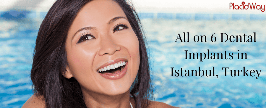 All on 6 Dental Implants in Istanbul, Turkey