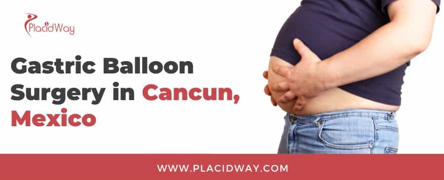 Gastric Balloon Surgery in Cancun, Mexico