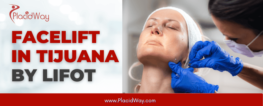 Facelift In Tijuana By Lifot