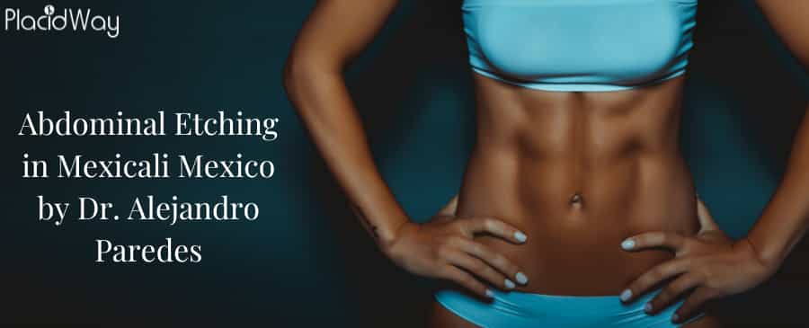 Abdominal Etching In Mexicali Mexico By Dr. Alejandro Paredes