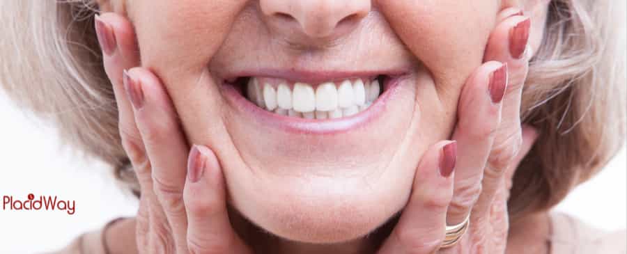 Full Mouth Dental Implants in Turkey