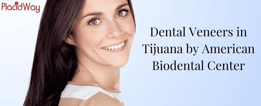 Dental Veneers in Tijuana