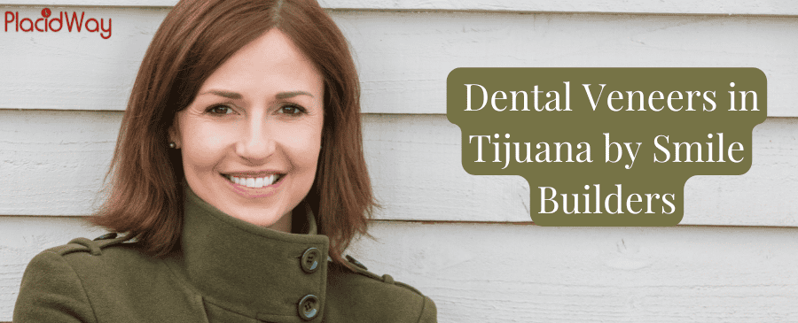  Dental Veneers in Tijuana by Smile Builders