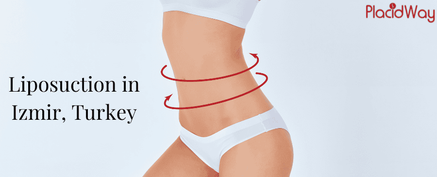 Liposuction in Izmir, Turkey