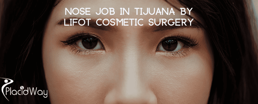 Nose Job In Tijuana By Lifot Cosmetic Surgery