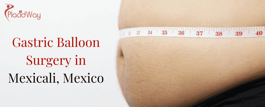 Gastric Balloon Surgery in Mexicali, Mexico
