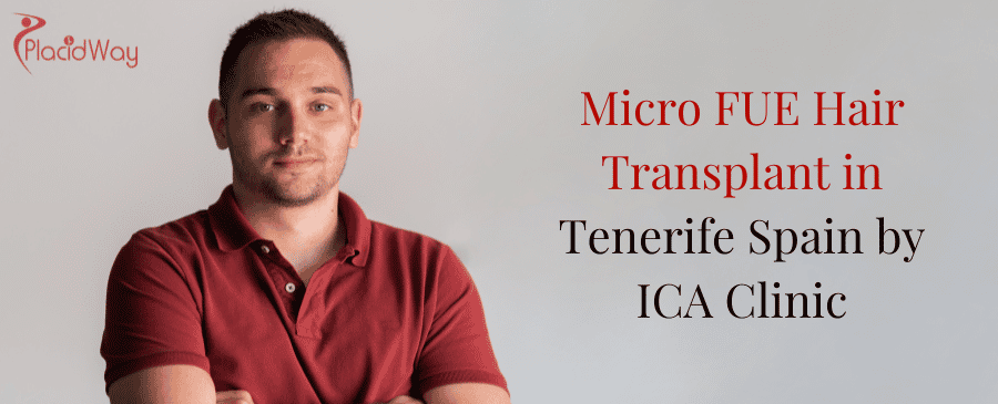 Micro FUE Hair Transplant in Tenerife Spain