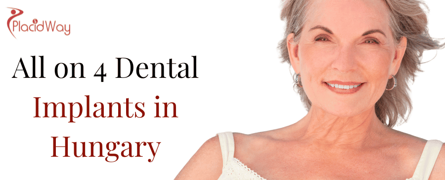 All On  Dental Implants In Hungary
