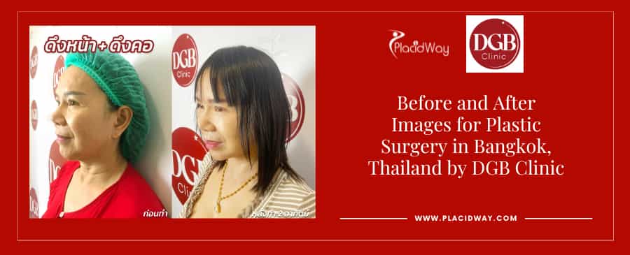 Before and After Plastic Surgery in Bangkok, Thailand 
