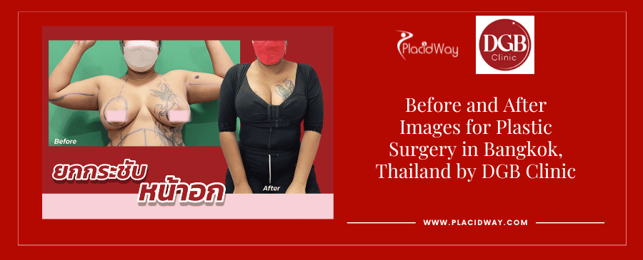 Before and After Plastic Surgery in Bangkok, Thailand 