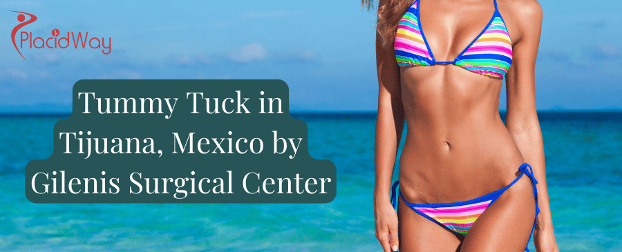 Tummy Tuck in Tijuana, Mexico