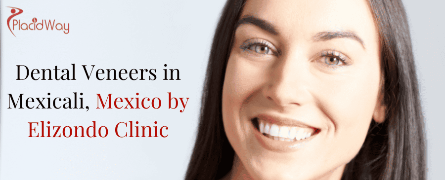 Dental Veneers in Mexicali, Mexico