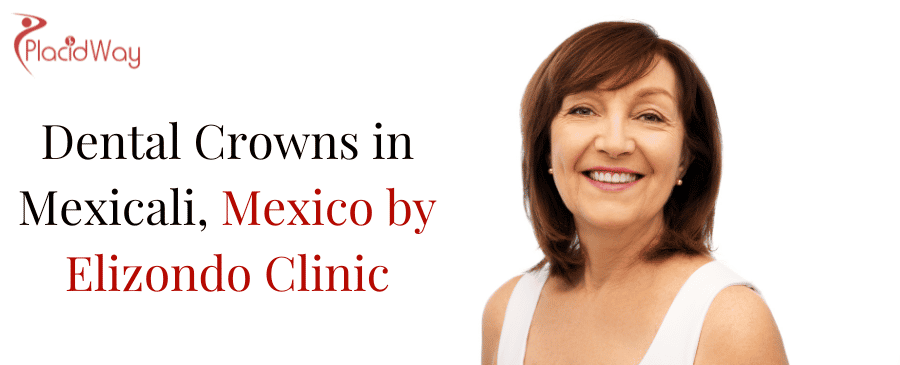 Dental Crowns in Mexicali, Mexico