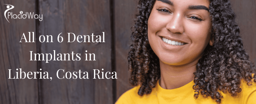 All on 6 Dental Implants in Liberia, Costa Rica